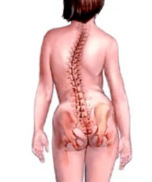 Pathology of the muskuloskelet system