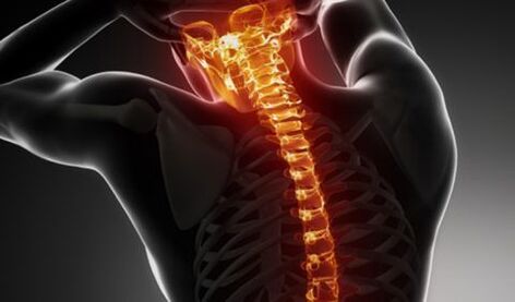 Osteocondrosis of the entire spine