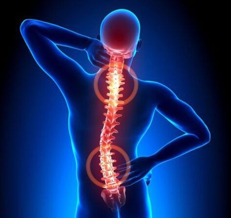Osteocondrosis of the spine