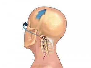 How does the osteocondrosis of cervical spine manifest