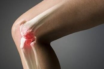 The arterry of the knee joint is the lesion of cartilage tissue